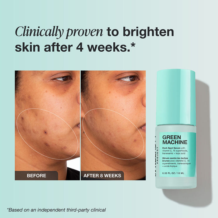 Brightening Essentials Kit