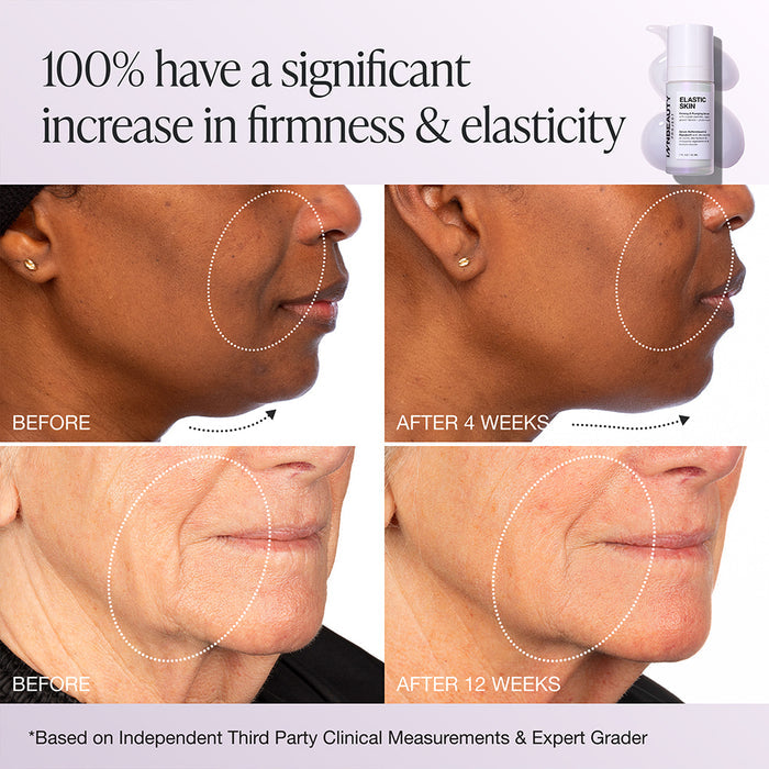 Elastic Skin