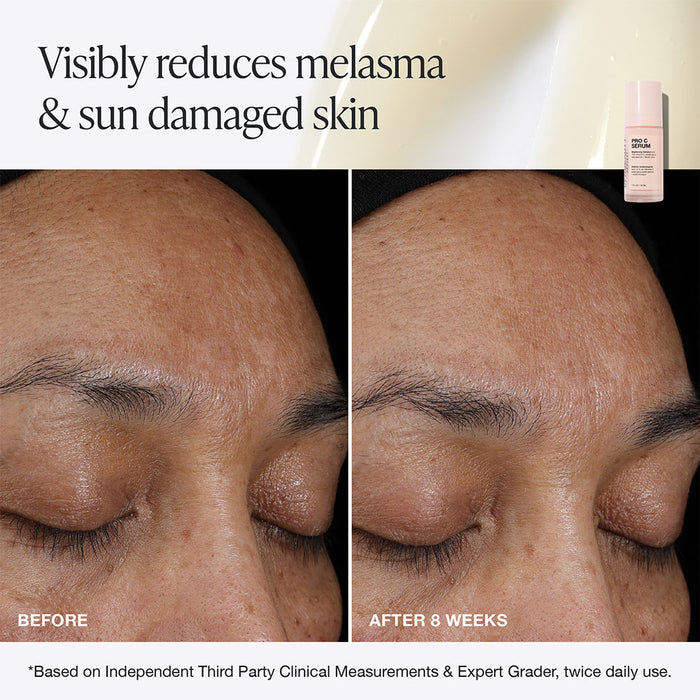 Pro C Serum
