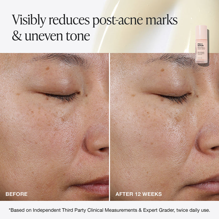 Pro C Serum