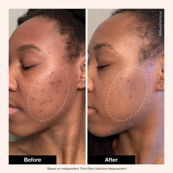 Retinol Remix 1% Retinol