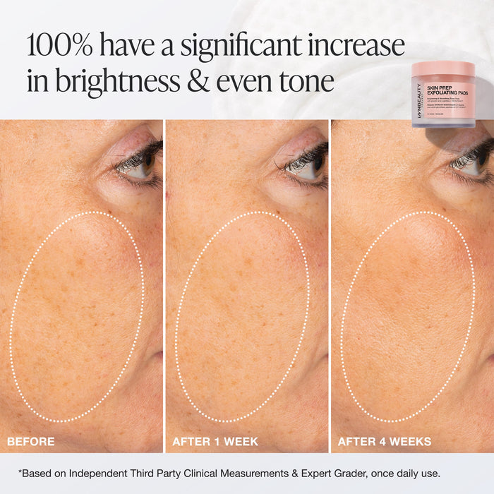 Skin Prep Exfoliating Pads