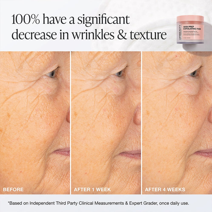 Skin Prep Exfoliating Pads
